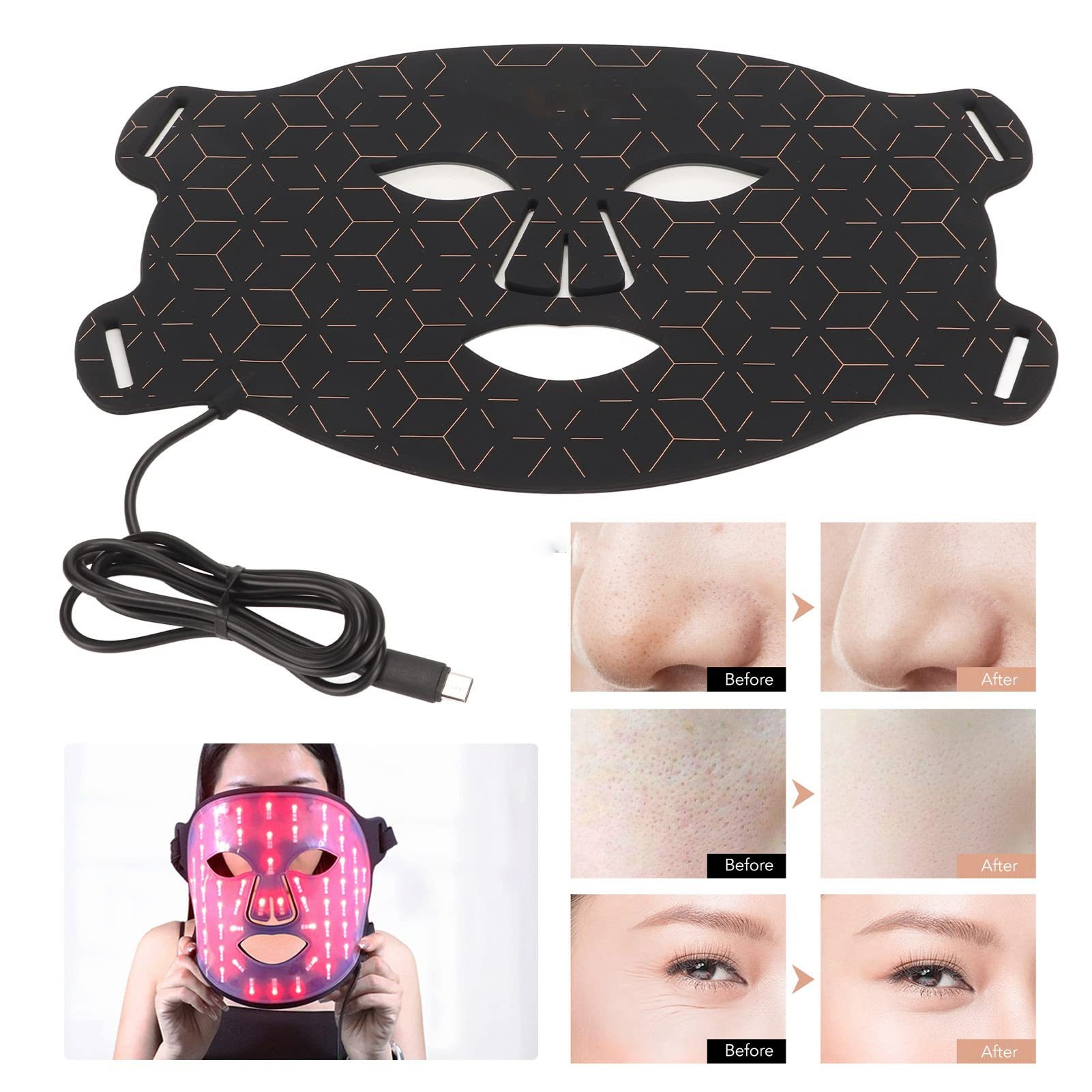 “Food Grade Silicone Beauty Mask with LED Photons – advanced skincare mask with LED therapy for radiant, healthy skin – Hot Deal Warehouse beauty tech”
