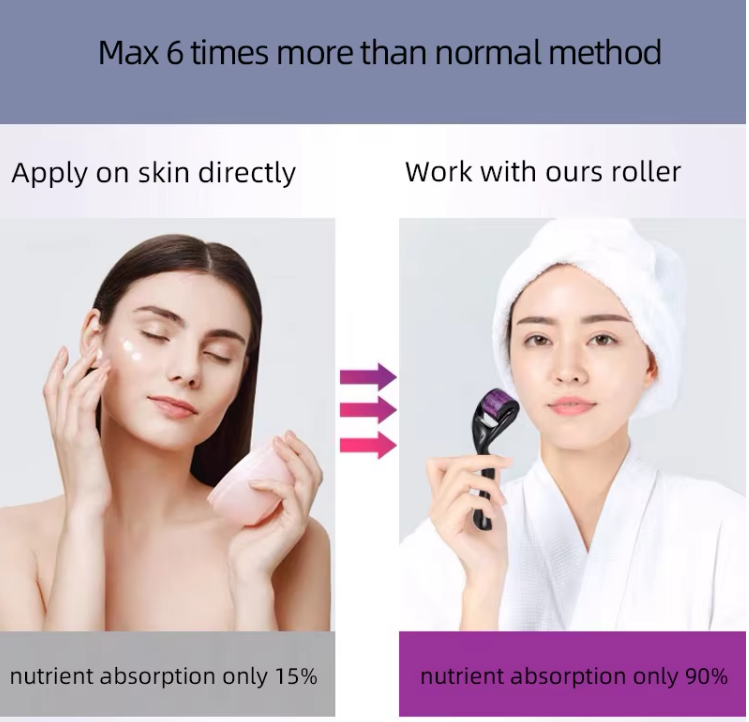 “540 micro needle derma roller – skin rejuvenation tool for improved absorption and smoother, healthier skin – Hot Deal Warehouse beauty”

